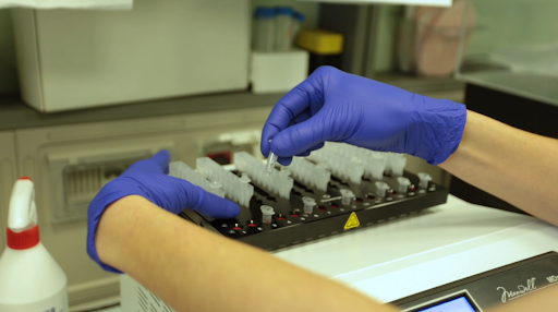 Coronavirus, ad Asti sono 95 i decessi in totale. 806 le persone positive