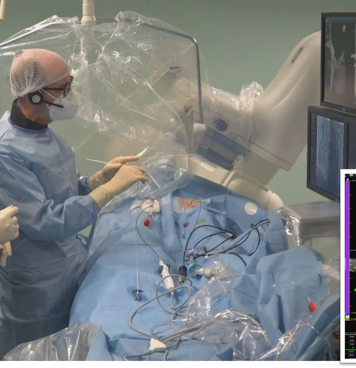 Webinar reparto cardiologia di Asti