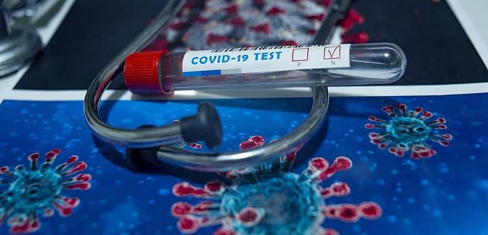 Covid-19, nell'Astigiano un nuovo decesso e 133 nuovi positivi. Cresce ancora la curva in Piemonte Covid-19, nell'Astigiano un nuovo decesso e 133 nuovi positivi. Cresce ancora la curva in Piemonte