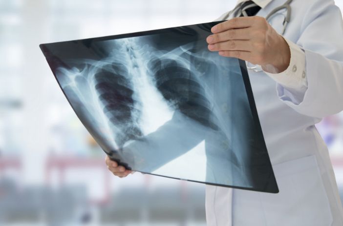 Radiologia domiciliare R@dhome: entro la fine dell'anno sarà estesa a tutto il Piemonte