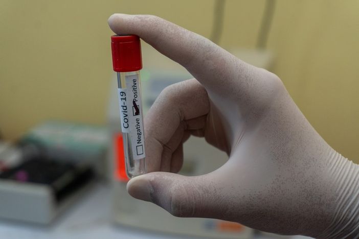 Aggiornamento Covid-19 in Piemonte: nessun decesso, 39 positivi al tampone e 14 nuovi guariti