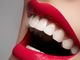 Studio Odontoiatrico Puzzilli:  tutti i trucchi per un sorriso smagliante, dall’alimentazione al make up