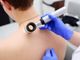 Melanoma day: Piemonte in prima linea per la prevenzione e cura dei tumori della pelle Melanoma day: Piemonte in prima linea per la prevenzione e cura dei tumori della pelle
