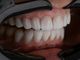 Igiene dentale con ultrasuoni: come prendersi cura dei denti con un approccio più preciso e delicato