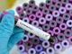Coronavirus, oggi ad Asti 5 decessi. 152 da inizio emergenza, ma salgono a 166 i guariti