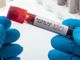 Coronavirus, non si arresta l'incremento di contagi: oggi sfiora i 1.000 nuovi positivi