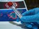 Covid: in Piemonte andamento stazionario, con vaccinazioni in aumento