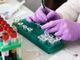 Coronavirus, autorizzati in Piemonte i test sierologici presso i laboratori privati