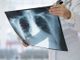Radiologia domiciliare R@dhome: entro la fine dell'anno sarà estesa a tutto il Piemonte