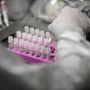 Rischio Long Covid, scoperta variante genetica che lo aumenta del 60%