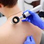 Melanoma day: Piemonte in prima linea per la prevenzione e cura dei tumori della pelle