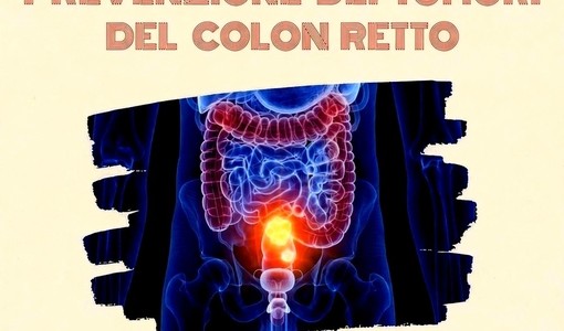 Prevenzione del tumore al colon retto, a San Damiano un incontro dedicato alla salute