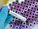 Emergenza coronavirus: 17 nuovi decessi in Piemonte, nessuno dei quali nell’Astigiano