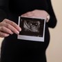 Fecondazione assistita: realizzare il desiderio di diventare genitori