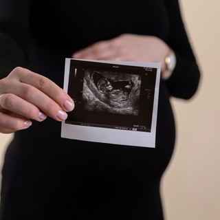 Fecondazione assistita: realizzare il desiderio di diventare genitori