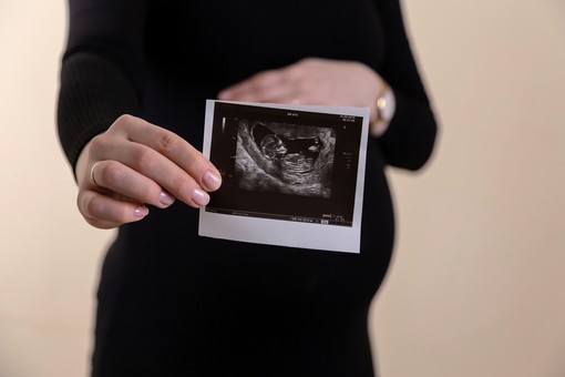 Fecondazione assistita: realizzare il desiderio di diventare genitori