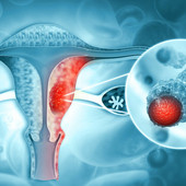 Tumore dell’endometrio, la diagnosi precoce può fare la differenza: specialisti a confronto al Polo Universitario Astiss