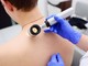 Melanoma day: Piemonte in prima linea per la prevenzione e cura dei tumori della pelle
