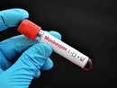 Vaiolo delle scimmie: nuove indicazioni con una circolare della Regione Piemonte