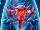 Sabato  ad Asti screening gratuito per il tumore al collo dell'utero