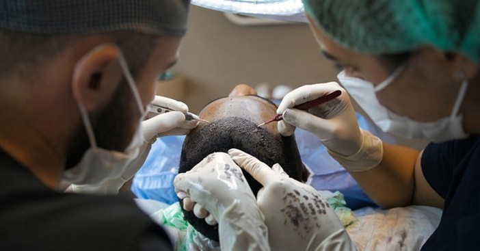 Trapianto capelli Turchia: come pianificare bene e riconoscere una clinica affidabile