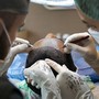 Trapianto capelli Turchia: come pianificare bene e riconoscere una clinica affidabile