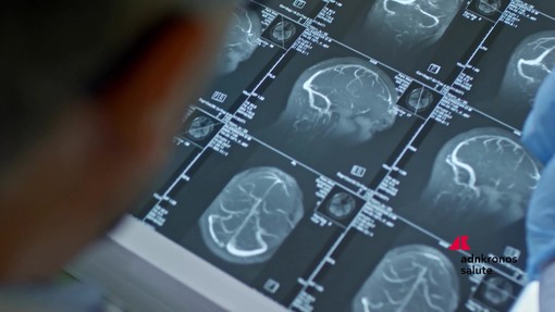 Fenilchetonuria, 'screening neonatale evita danni neurologici ma serve continuità assistenziale' Fenilchetonuria, 'screening neonatale evita danni neurologici ma serve continuità assistenziale'