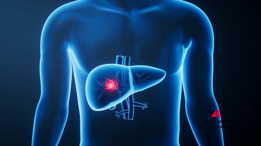 Giornata epatiti, esperti 'terapie efficaci, screening di prossimità per le virali'