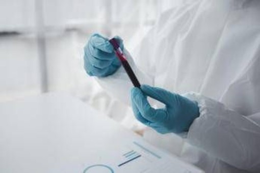 Epatite A in forte crescita in Italia: Lazio, Campania e Puglia le regioni con più casi