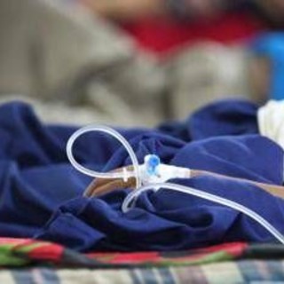 Lotta al melanoma, l'immunoterapia funziona meglio al mattino