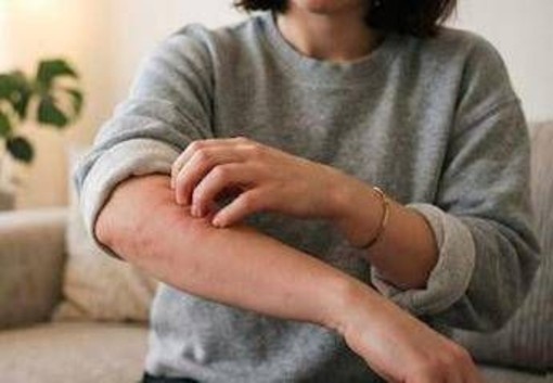 Malattia della pioggia, perché se ne parla: cos'è e sintomi Malattia della pioggia, perché se ne parla: cos'è e sintomi