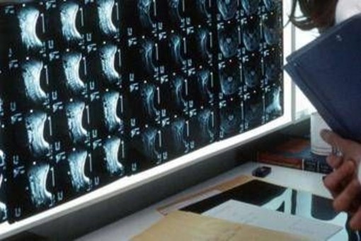 Oltre 500 malattie rare delle ossa, esperti: "Investire in prevenzione e diagnosi" Oltre 500 malattie rare delle ossa, esperti: "Investire in prevenzione e diagnosi"