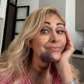 Marina Di Guardo, l'incidente in Sicilia con un trattore: il racconto sui social