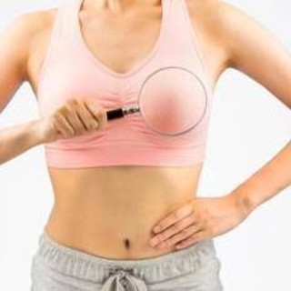 Cancro seno, esperti 'in Campania biopsia liquida utile per 720 donne l’anno'