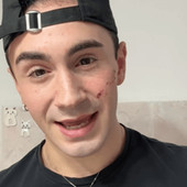 Genova, 19enne denuncia aggressione omofoba: "Sfregiato al viso con coltellino"