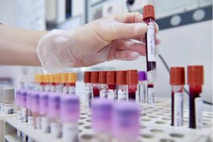 Dal microbiota una speranza contro l'epilessia resistente, lo studio italiano Dal microbiota una speranza contro l'epilessia resistente, lo studio italiano