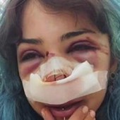 Bari, studentessa picchiata nei bagni denuncia nuovo episodio: "Mi hanno accerchiata"