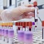 Tumore alla prostata, novità nelle terapie dei casi più gravi