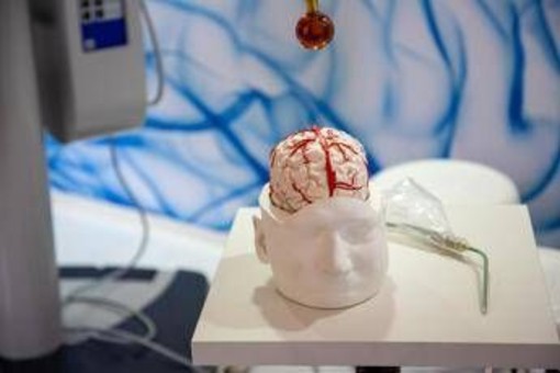 Dai gliomi al Parkinson, così l’intelligenza artificiale aiuta la Neurochirurgia