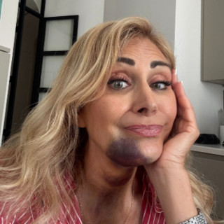 Marina Di Guardo, l'incidente in Sicilia con un trattore: il racconto sui social Marina Di Guardo, l'incidente in Sicilia con un trattore: il racconto sui social