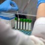 Medicina, italiani svelano errori nascosti nelle cellule: &quot;Possibile ruolo in più malattie&quot;