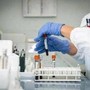 Miastenia gravis, al via studio su qualità di vita e impatto socio-sanitario