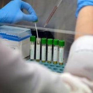 Medicina, italiani svelano errori nascosti nelle cellule: &quot;Possibile ruolo in più malattie&quot;