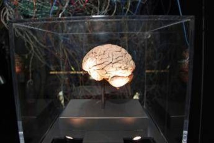 Medicina, neurologi: "L'innovazione può cambiare la storia di molte malattie ma serve equità" Medicina, neurologi: "L'innovazione può cambiare la storia di molte malattie ma serve equità"