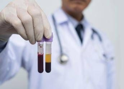 Farmaceutica, Gardini (GenomeUp): &quot;Ai per programmare terapie con plasmaderivati&quot;