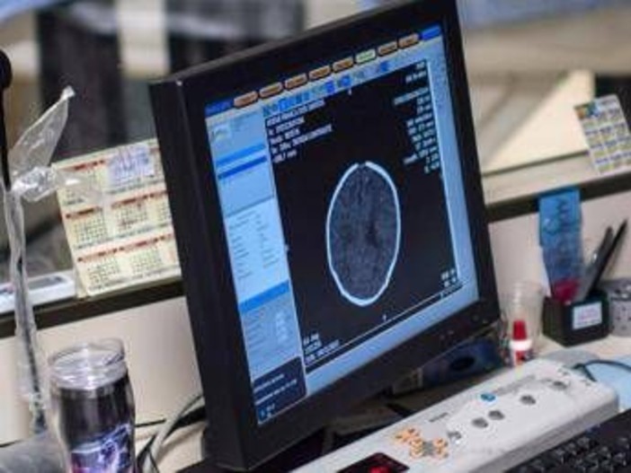 Salute, Padovani (Sin): "Longevità aumenta rischio Alzheimer, agire su prevenzione" Salute, Padovani (Sin): "Longevità aumenta rischio Alzheimer, agire su prevenzione"