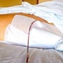 Fine vita, Sin: &quot;Cure palliative fondamentali per pazienti neurologici&quot;