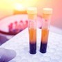 Farmaci, Sava (Sif Magazine): &quot;In plasmaderivati attenzione particolare a sicurezza&quot;