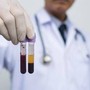 Farmaceutica, Gardini (GenomeUp): &quot;Ai per programmare terapie con plasmaderivati&quot;