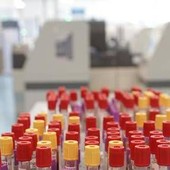 Cos'è il batterio mangiacarne sotto la lente a Messina, minaccia in crescita per il caldo record